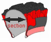 section